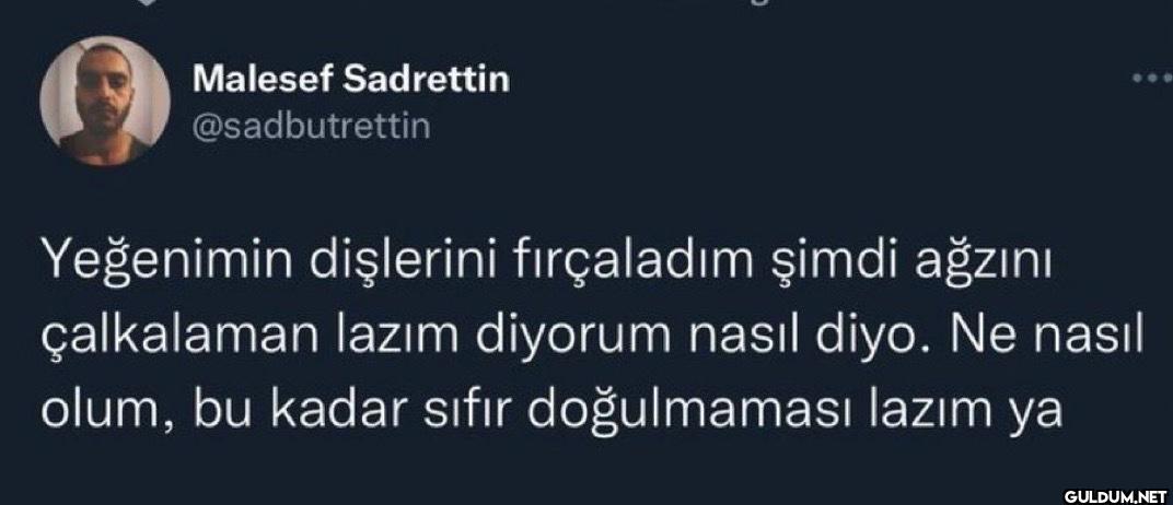 Yeğenimin dişlerini...