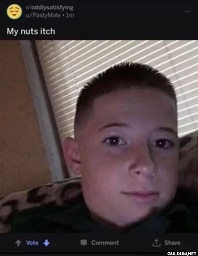 u PastyMale 1m My nuts itch