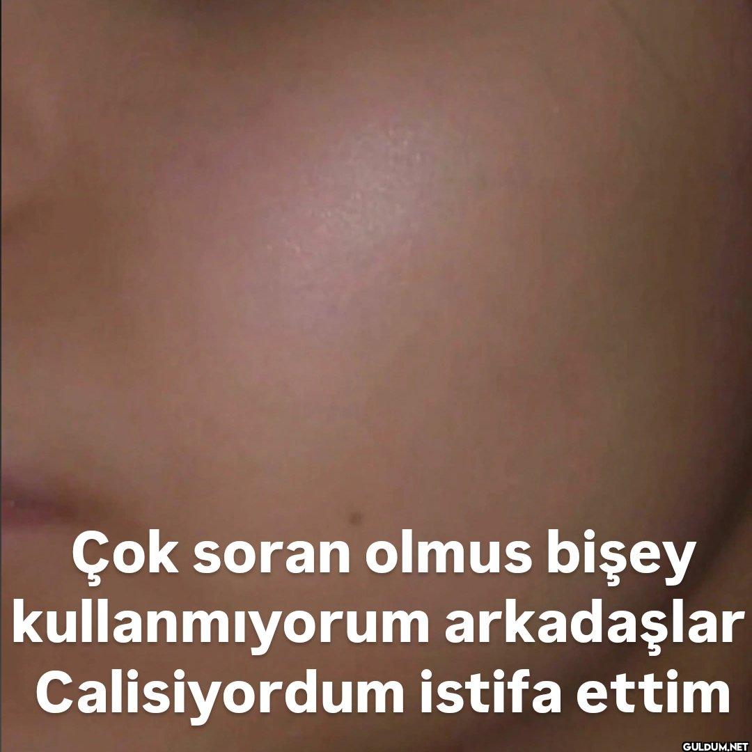 Çok soran olmus bişey...