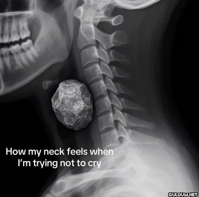 How my neck feels when I'm...