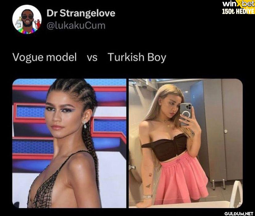 Vogue model vs Turkish Boy...