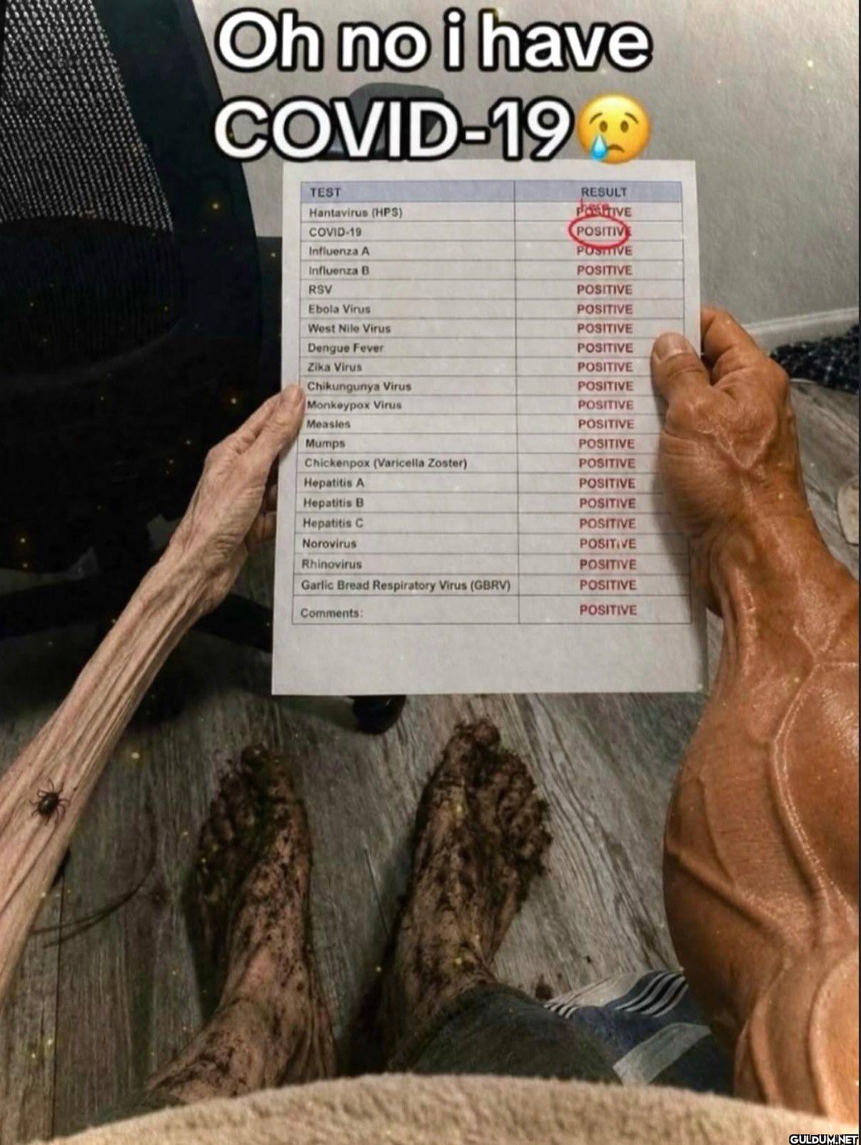 Oh no i have COVID-19 TEST...