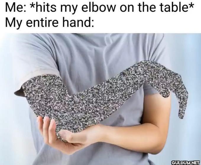 Me hits my elbow on the...