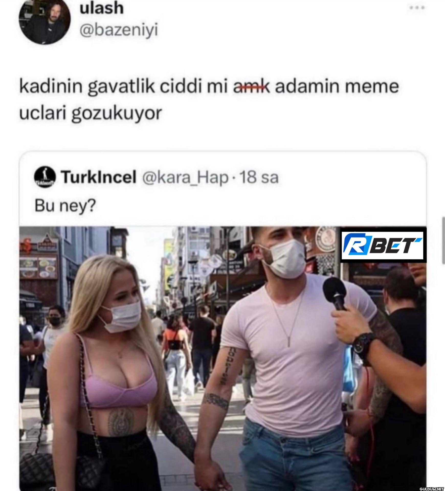 kadinin gavatlik ciddi mi...