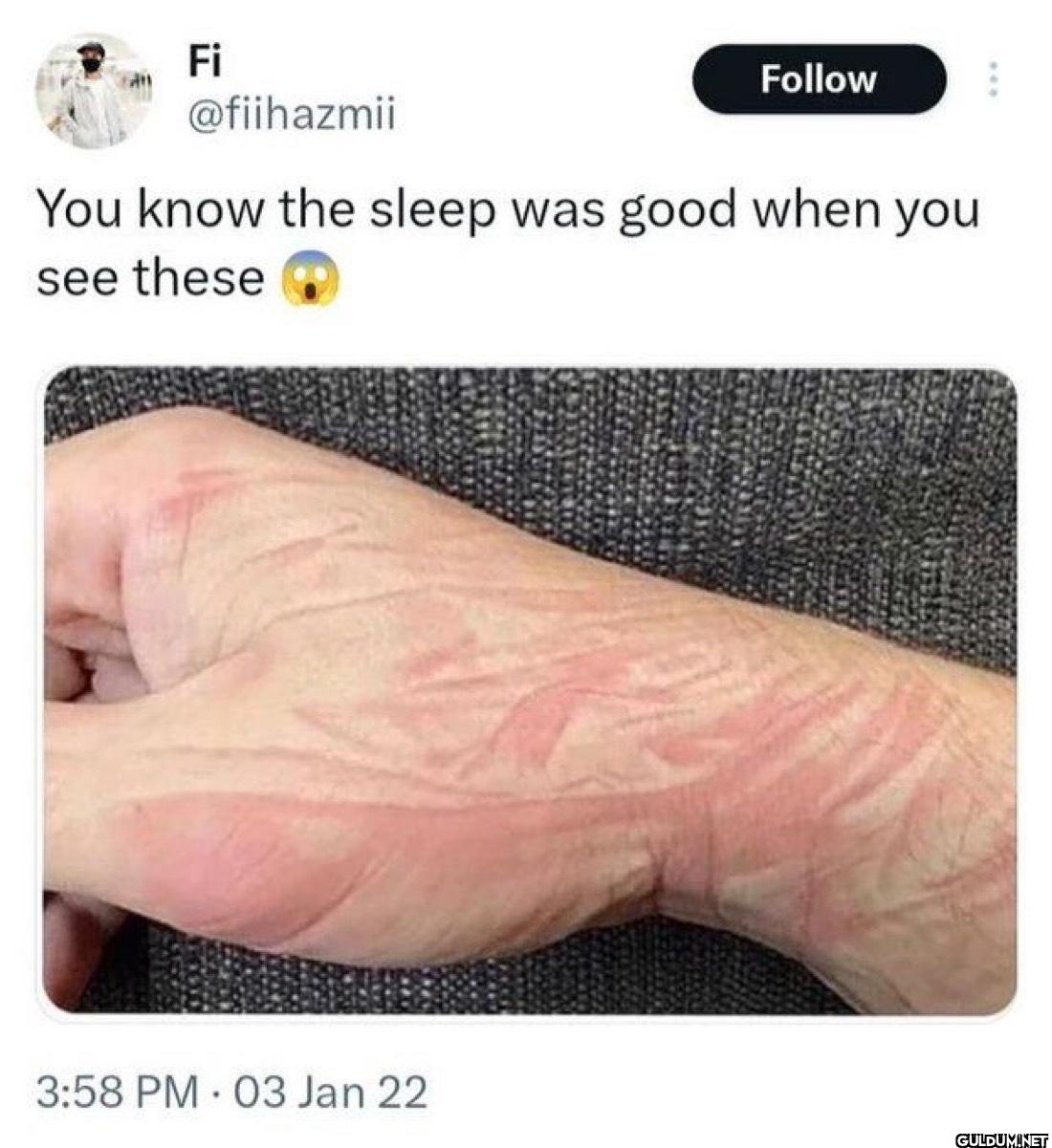 You know the sleep was...