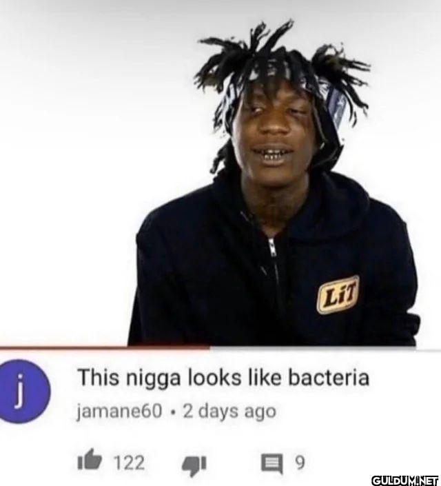 This nigga looks bacteria...