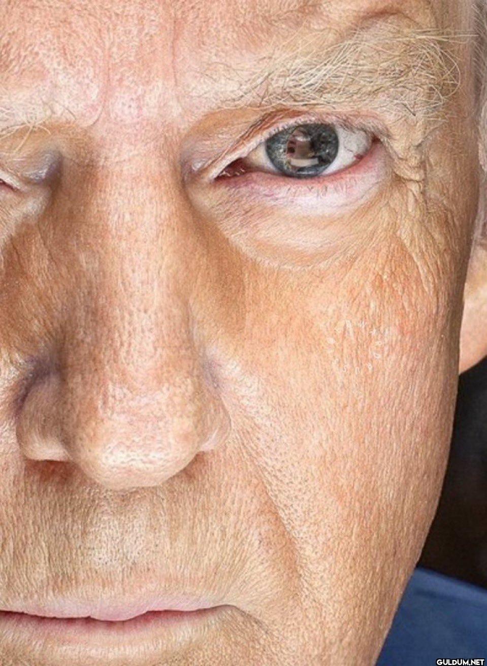 Zoom in on Trump's eye, I dare you.