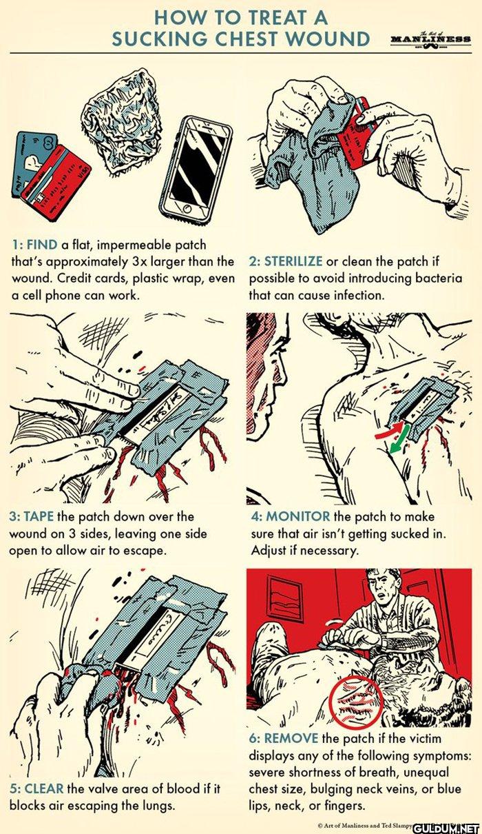 15. How To Treat A Sucking...