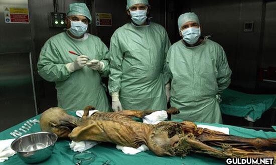 Ayrıca Ötzi’nin arka...
