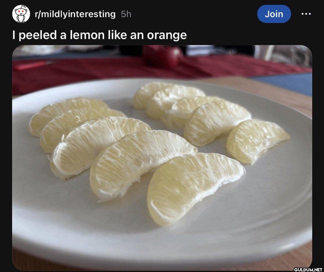 r/mildlyinteresting 5h I...