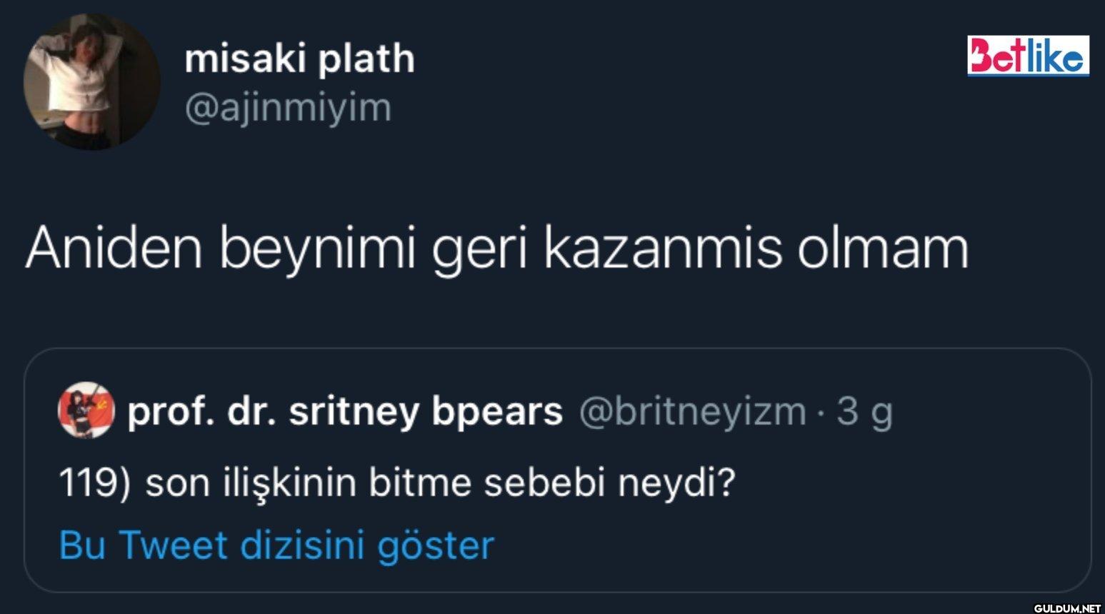 Aniden beynimi geri...